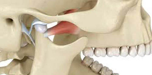 Temporomandibular joint (TMJ) Treatment & Surgery in NAgpur